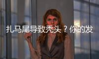 扎马尾导致秃头？你的发际线处处存在危机！